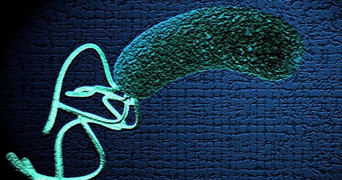 Cholera outbreaks surging worldwide: WHO Cholera outbreaks surging worldwide: WHO