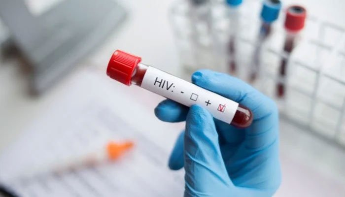 Over 500 people test positive for HIV in Islamabad in last 10 months