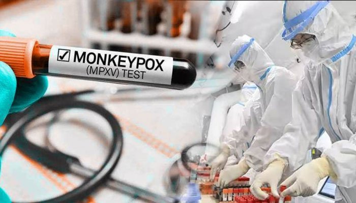 Pakistan reports first monkeypox case