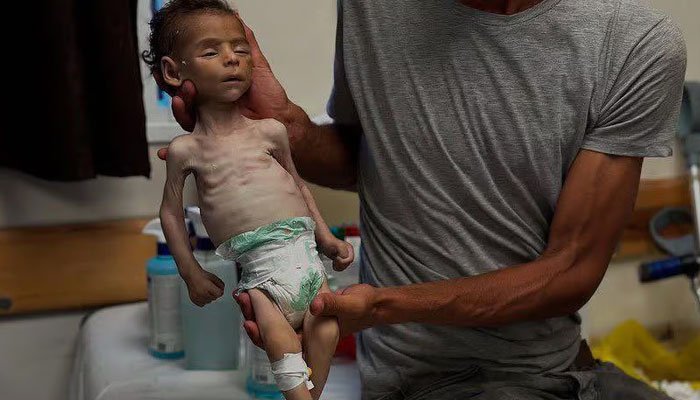 Gaza Baby Dies of Hunger Along with 116 Amid Israeli Attacks on Aid Sites