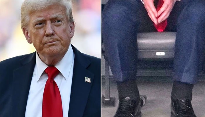 While House Reveals Trump Diagnosed with Chronic Venous Insufficiency