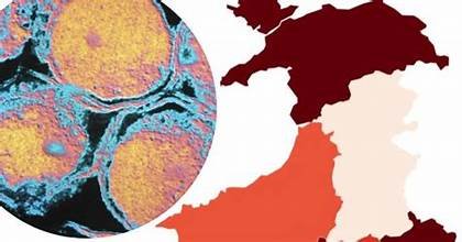 Europe STI Crisis Hits 10-Year High — What Travelers Must Know Now